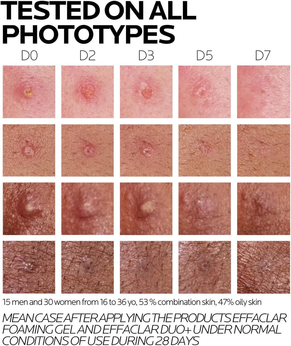 LA ROCHE POSAY Gel-crema anti-imperfectiuni Effaclar Duo+M x 40ml